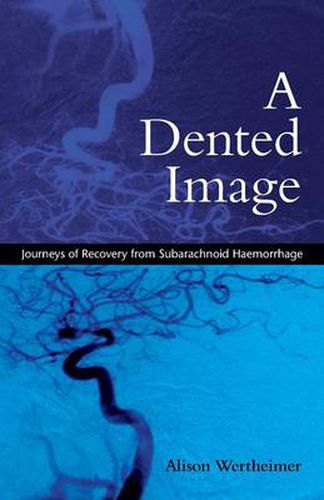 Cover image for A Dented Image: Journeys of Recovery from Subarachnoid Haemorrhage