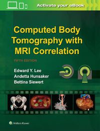 Cover image for Computed Body Tomography with MRI Correlation