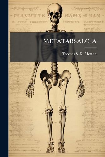 Cover image for Metatarsalgia