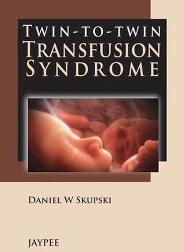 Cover image for Twin-to-Twin Transfusion Syndrome