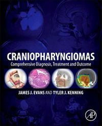 Cover image for Craniopharyngiomas: Comprehensive Diagnosis, Treatment and Outcome