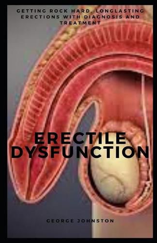 Erectile Dysfunction: Getting rock hard, longlasting erections with diagnosis and treatment