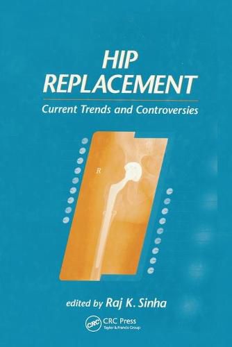 Cover image for Hip Replacement: Current Trends and Controversies