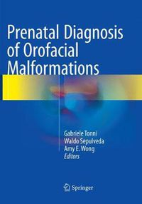 Cover image for Prenatal Diagnosis of Orofacial Malformations