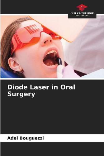 Cover image for Diode Laser in Oral Surgery