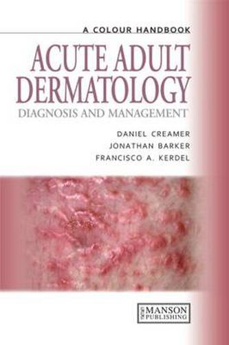 Cover image for Acute Adult Dermatology: Diagnosis and Management: A Colour Handbook