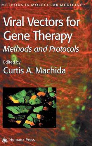 Cover image for Viral Vectors for Gene Therapy: Methods and Protocols