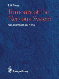 Cover image for Tumours of the Nervous System: an Ultrastructural Atlas
