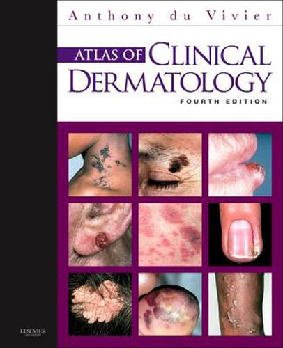 Cover image for Atlas of Clinical Dermatology