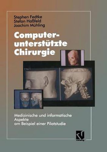 Computerunterstutzte Chirurgie: Medizinische Und Informatische Aspekte Am Beispiel Einer Pilotstudie