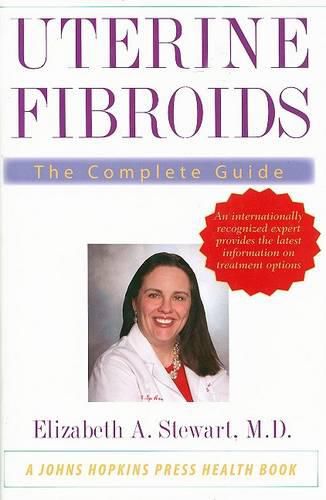 Uterine Fibroids: The Complete Guide