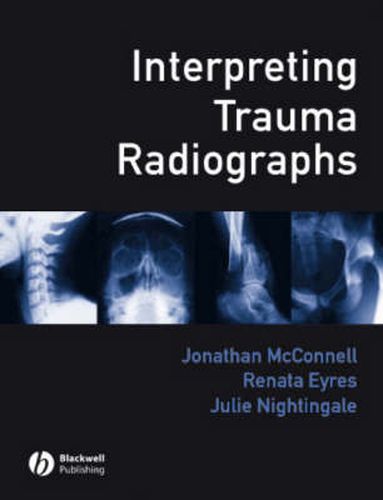 Cover image for Interpreting Trauma Radiographs