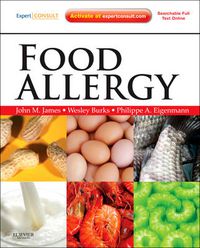 Cover image for Food Allergy: Expert Consult Basic