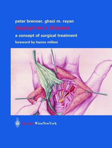 Cover image for Dupuytren's Disease: A Concept of Surgical Treatment