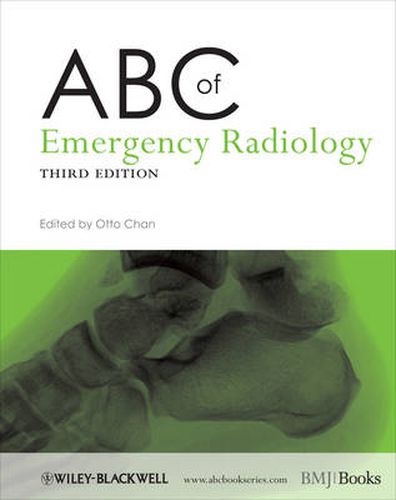 Cover image for ABC of Emergency Radiology 3e