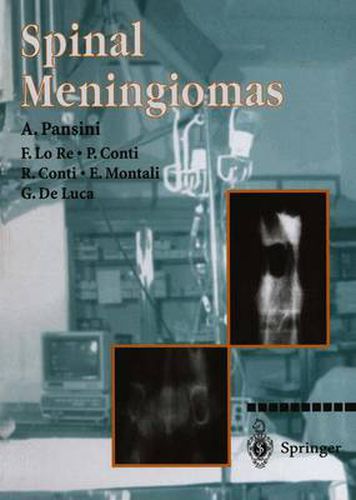 Cover image for Spinal Meningiomas
