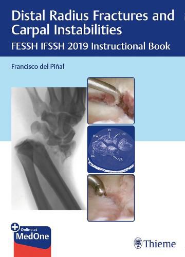 Cover image for Distal Radius Fractures and Carpal Instabilities: FESSH IFSSH 2019 Instructional Book