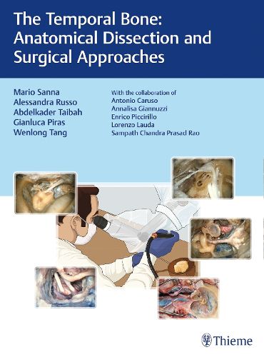 Cover image for The Temporal Bone: Anatomical Dissection and Surgical Approaches