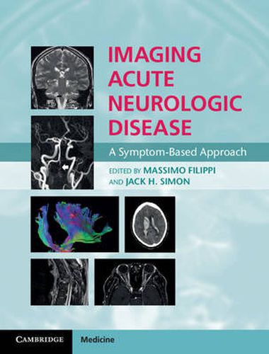 Cover image for Imaging Acute Neurologic Disease: A Symptom-Based Approach