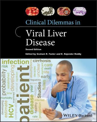 Cover image for Clinical Dilemmas in Viral Liver Disease