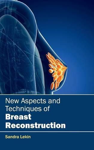 Cover image for New Aspects and Techniques of Breast Reconstruction
