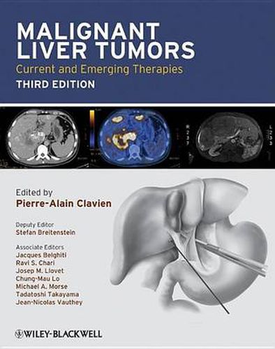 Cover image for Malignant Liver Tumors: Current and Emerging Therapies