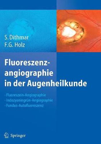 Cover image for Fluoreszenzangiographie in Der Augenheilkunde: Fluoreszein-angiographie, Indozyaningrun-angiographie Und Fundus-autofluoreszenz