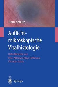 Cover image for Auflichtmikroskopische Vitalhistologie: Dermatologischer Leitfaden