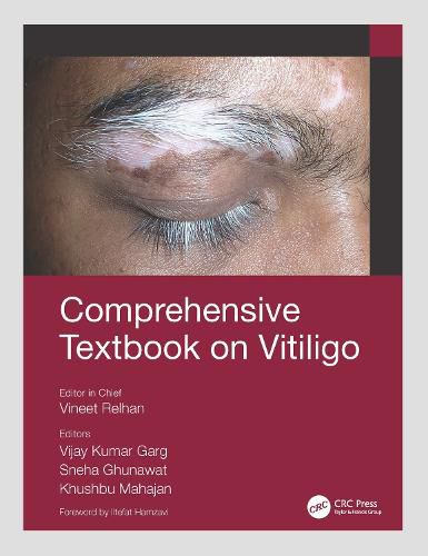 Cover image for Comprehensive Textbook on Vitiligo