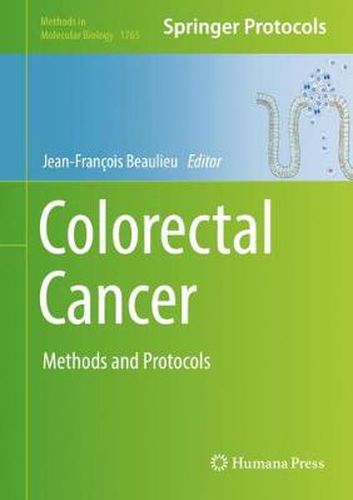 Cover image for Colorectal Cancer: Methods and Protocols