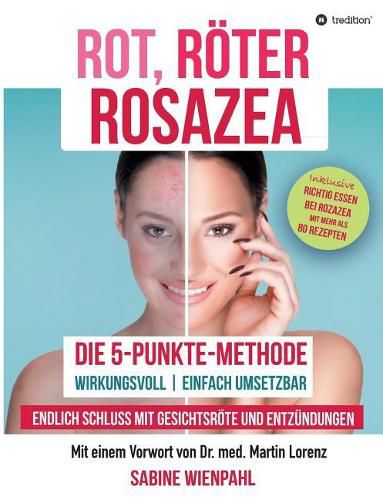 Cover image for Rot Roeter Rosazea