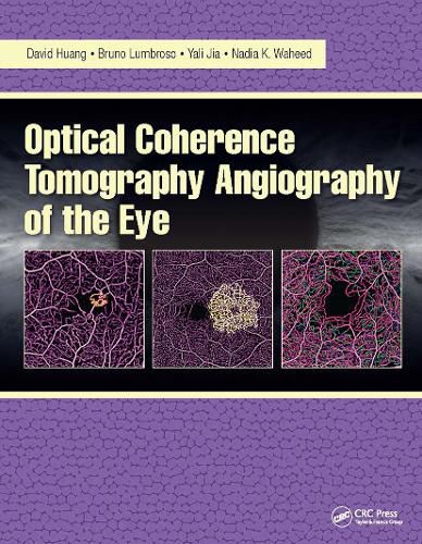 Cover image for Optical Coherence Tomography Angiography of the Eye: OCT Angiography