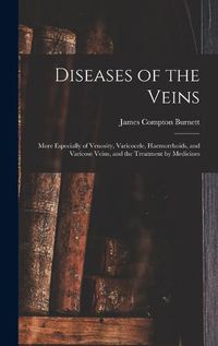 Cover image for Diseases of the Veins