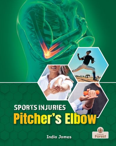 Cover image for Pitcher's Elbow