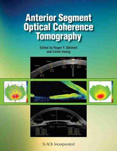 Cover image for Anterior Segment Optical Coherence Tomography