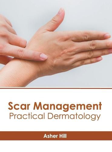 Cover image for Scar Management: Practical Dermatology