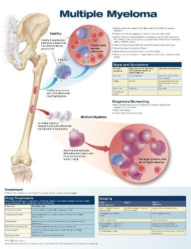 Cover image for Multiple Myeloma Anatomical Chart