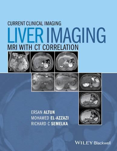 Liver Imaging - MRI with CT Correlation