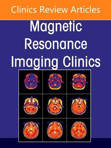 Spine Imaging, An Issue of Magnetic Resonance Imaging Clinics of North America: Volume 33-2