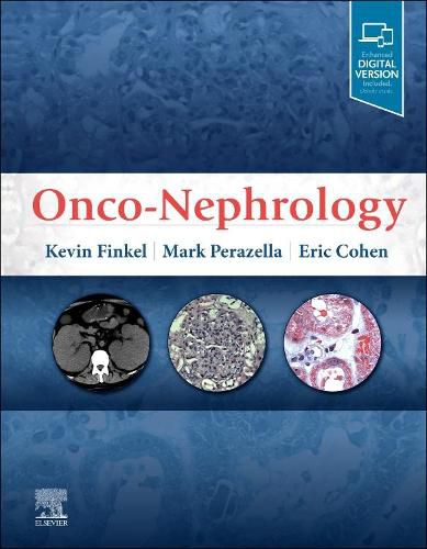 Cover image for Onco-Nephrology