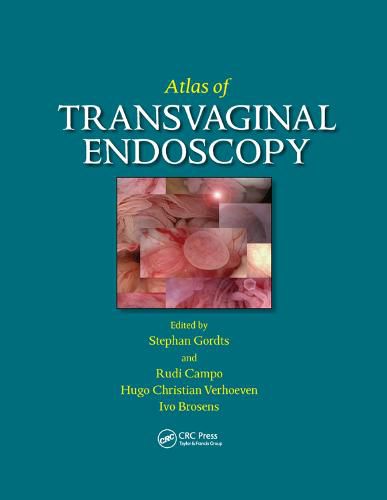 Cover image for Atlas of Transvaginal Endoscopy