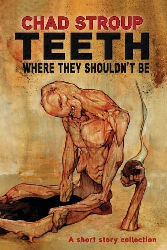 Cover image for Teeth Where They Shouldn't Be