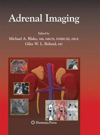 Cover image for Adrenal Imaging