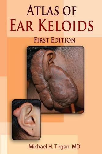 Cover image for Atlas of Ear Keloids