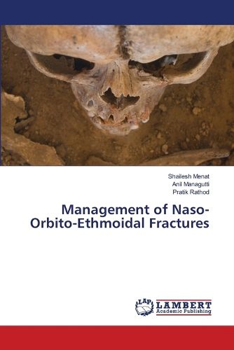 Cover image for Management of Naso-Orbito-Ethmoidal Fractures