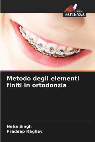 Cover image for Metodo degli elementi finiti in ortodonzia