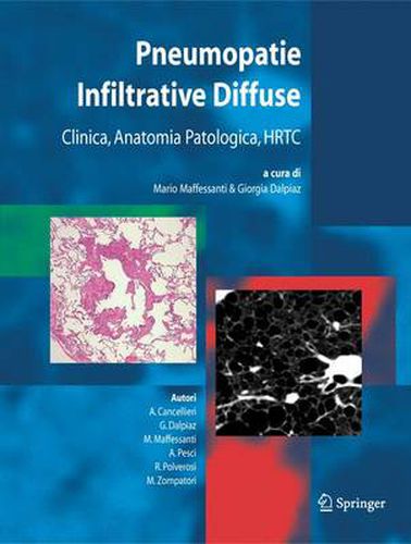 Cover image for Pneumopatie Infiltrative Diffuse: Clinica, Anatomia Patologica, HRTC