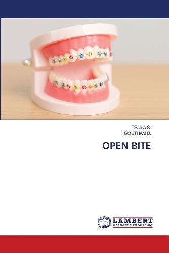 Cover image for Open Bite