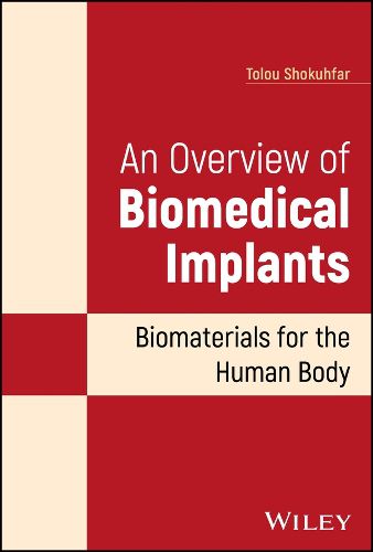 Cover image for An Overview of Biomedical Implants