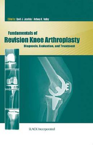 Cover image for Fundamentals of Revision Knee Arthroplasty: Diagnosis, Evaluation, and Treatment